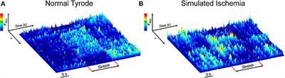 Ischemia Enhances the Acute Stretch-Induced Increase in Calcium Spark Rate in Ventricular Myocytes